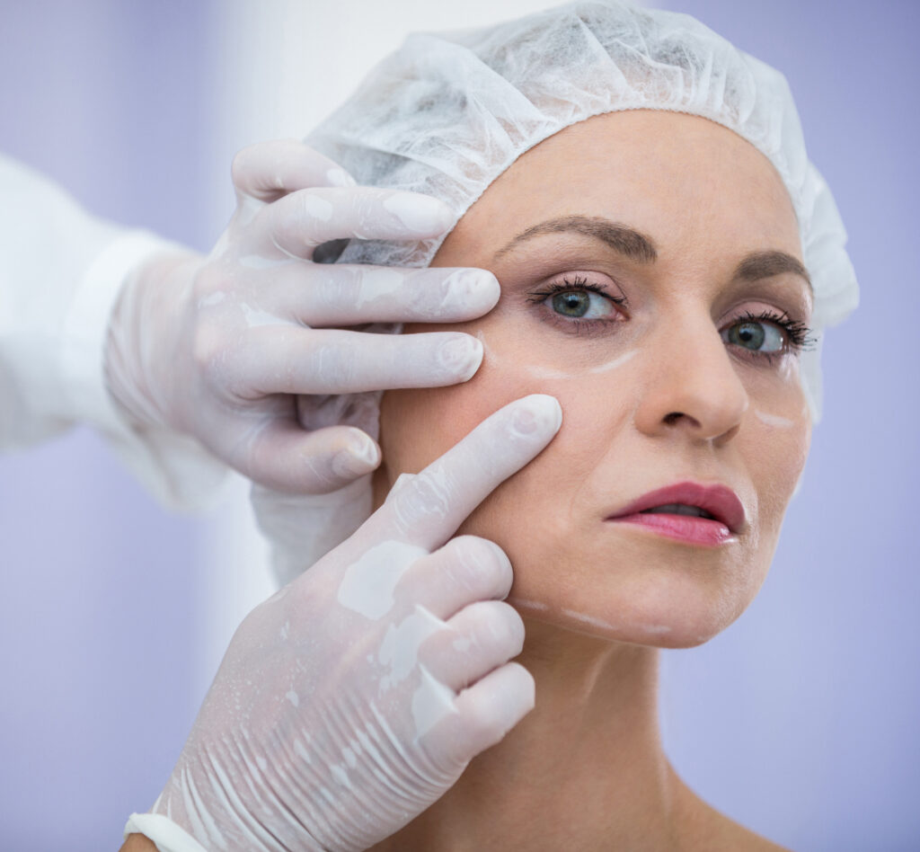 ¿Qué son los bioestimuladores? Dr. David Lurduy